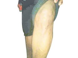 遭2掠夺匪夹击　印裔妇女勇退2匪