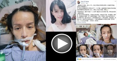 患重症肌无力 单亲妈妈只剩32公斤