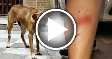 怒！ 凶恶家犬又咬伤人 女狗主全程冷眼旁观