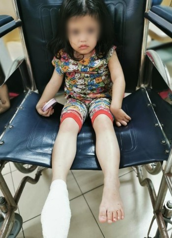 艾拉右脚伤势被上传抖音后获浏 览近40万次。
